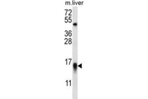 Western Blotting (WB) image for anti-C-Myc Binding Protein (MYCBP) antibody (ABIN2996726) (MYCBP antibody)