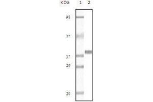 Western blot analysis using Myoglobin mouse mAb against truncated Myoglobin recombinant protein(AA: 2-154).