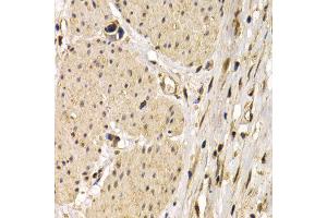 Immunohistochemistry (IHC) image for anti-CD40 (CD40) antibody (ABIN3020704) (CD40 antibody)