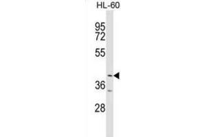 Western Blotting (WB) image for anti-Ankyrin Repeat and BTB (POZ) Domain Containing 1 (ABTB1) antibody (ABIN2999338) (ABTB1 antibody)