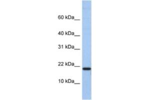 Western Blotting (WB) image for anti-C1D Nuclear Receptor Corepressor (C1D) antibody (ABIN2463344)