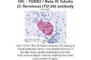 Image no. 1 for anti-Tubulin, beta 3 (TUBB3) (N-Term) antibody (ABIN1724161) (TUBB3 antibody  (N-Term))