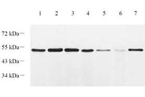 Western blot analysis of EIF2S2 (ABIN7073880) at dilution of 1: 1000,Lane 1: HT29 cell lysate,Lane 2: L1299 cell lysate,Lane 3: CaCO2 cell lysate,Lane 4: Mouse lung tissue lysate,Lane 5: Mouse colon tissue lysate,Lane 6: Mouse small intestine tissue lysate,Lane 7: Rat lung tissue lysate (EIF2S2 antibody)
