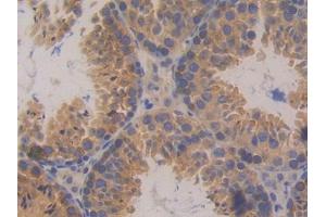 DAB staining on IHC-P; Samples: Mouse Testis Tissue (PKD2 antibody  (AA 327-539))