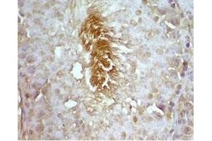 Rat testis tissue was stained by rabbit Anti-Desnutrin (296-318) (Mouse) Serum (PNPLA2 antibody  (AA 296-318))
