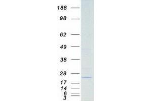 STK32A Protein (Transcript Variant 2) (Myc-DYKDDDDK Tag)