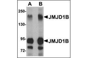 Western blot analysis of JMJD1B in rat liver tissue lysate with this product at (A) 1 and (B) 2 μg/ml. (KDM3B antibody  (Center))