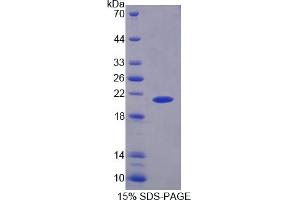 SDS-PAGE of Protein Standard from the Kit (Highly purified E. (PYGL ELISA Kit)