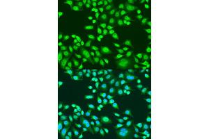 Immunofluorescence analysis of U2OS cells using PAX8 antibody (ABIN1874050) at dilution of 1:100. (PAX8 antibody)