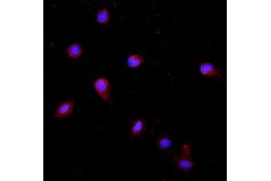 IF analysis of Krt20 using anti-Krt20 antibody (ABIN7601133). (KRT20 antibody  (AA 29-431))