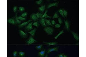 Immunofluorescence analysis of U-2 OS cells using REXO2 Polyclonal Antibody at dilution of 1:100 (40x lens).