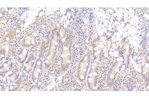 Detection of ADAMTS9 in Human Small intestine Tissue using Polyclonal Antibody to A Disintegrin And Metalloproteinase With Thrombospondin 9 (ADAMTS9) (ADAMTS9 antibody  (AA 1727-1935))