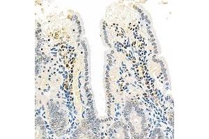 Immunohistochemistry analysis of paraffin-embedded mouse colon using,EEA1 (ABIN7073795) at dilution of 1: 2500 (EEA1 antibody)