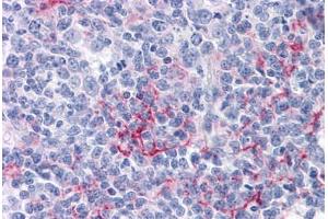 Human Tonsil: Formalin-Fixed, Paraffin-Embedded (FFPE) (FCER2 antibody)