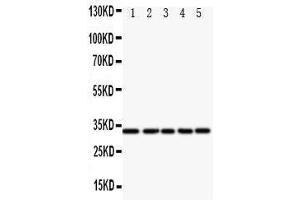 Western Blotting (WB) image for anti-E2F Transcription Factor 6 (E2F6) (AA 162-177), (Middle Region) antibody (ABIN3044189) (E2F6 antibody  (Middle Region))