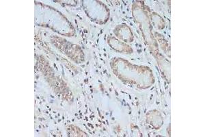 Immunohistochemistry of paraffin-embedded human stomach using TCEB2 antibody (ABIN6131621, ABIN6148934, ABIN6148936 and ABIN6217328) at dilution of 1:100 (40x lens). (TCEB2 antibody  (AA 1-118))