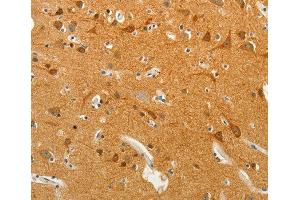 Immunohistochemistry (IHC) image for anti-Solute Carrier Family 18 (Vesicular Monoamine Transporter), Member 2 (SLC18A2) antibody (ABIN3016723) (SLC18A2 antibody)