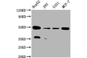Western Blot Positive WB detected in:HepG2 whole cell lysate, 293 whole cell lysate, U251 whole cell lysate, MCF-7 whole cell lysate All lanes: UQCRC2 antibody at 1:2000 Secondary Goat polyclonal to rabbit IgG at 1/50000 dilution Predicted band size: 49 kDa Observed band size: 49 kDa (Recombinant UQCRC2 antibody)