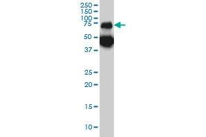 TPP1 monoclonal antibody (M01), clone 3B1 Western Blot analysis of TPP1 expression in A-431 . (TPP1 antibody  (AA 195-304))