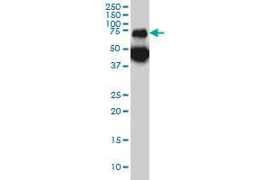 TPP1 monoclonal antibody (M01), clone 3B1 Western Blot analysis of TPP1 expression in A-431 .