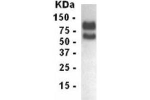 Western Blotting (WB) image for anti-Low Density Lipoprotein Receptor (LDLR) (AA 29-205) antibody (ABIN2467854) (LDLR antibody  (AA 29-205))