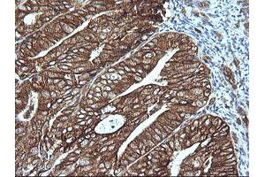 Image no. 2 for anti-Mitogen-Activated Protein Kinase Kinase 1 (MAP2K1) antibody (ABIN1499375) (MEK1 antibody)