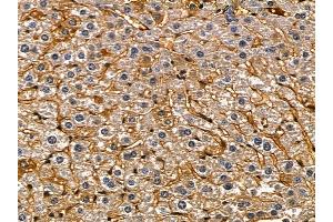 ABIN6260123 and ABIN6279669 at 1/100 staining mouse liver tissue by IHC-P.