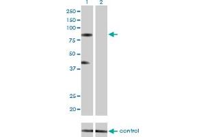 Western blot analysis of RNF103 over-expressed 293 cell line, cotransfected with RNF103 Validated Chimera RNAi (Lane 2) or non-transfected control (Lane 1).