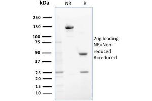 SDS-PAGE (SDS) image for anti-Glutathione S-Transferase mu 1 (GSTM1) antibody (ABIN6939573)