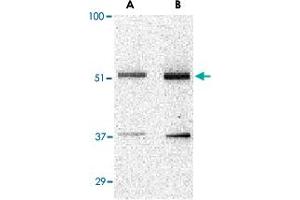 Western blot analysis of TANK in Daudi cell lysate with TANK polyclonal antibody  at (A) 0. (TANK antibody  (N-Term))