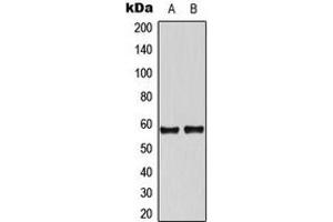 Western blot analysis of Tyrosine Hydroxylase expression in A549 (A), NIH3T3 (B) whole cell lysates. (Tyrosine Hydroxylase antibody  (N-Term))