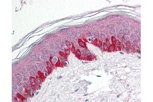Anti-STK11 / LKB1 antibody IHC of human skin. (LKB1 antibody  (N-Term))