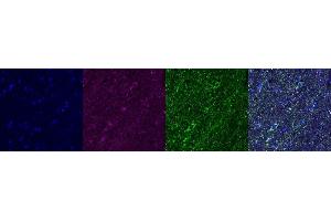 Immunohistochemistry (IHC) image for anti-ATP Synthase, H+ Transporting, Mitochondrial F1 Complex, alpha Subunit 1, Cardiac Muscle (ATP5A1) antibody (ABIN7456312)
