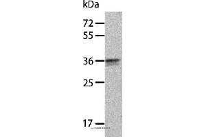 Western blot analysis of A549 cell, using ANXA8 Polyclonal Antibody at dilution of 1:300 (Annexin VIII antibody)