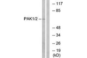 Western blot analysis of extracts from K562 cells, using PAK1/2 (Ab-199) Antibody. (PAK1/2 antibody  (AA 165-214))
