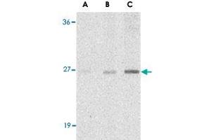 Western blot analysis of C1QTNF7 in NIH/3T3 cell lysate with C1QTNF7 polyclonal antibody  at (A) 1, (B) 2, and (C) 4 ug/mL . (CTRP7 antibody  (N-Term))