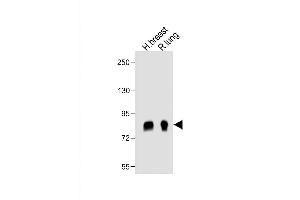 All lanes : Anti- POSTN Antibody (C-term) at 1:1000 dilution Lane 1: human breast lysate Lane 2: rat lung lysate Lysates/proteins at 20 μg per lane. (Periostin antibody  (C-Term))