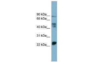 MPZL1 antibody used at 1 ug/ml to detect target protein. (MPZL1 antibody  (Middle Region))