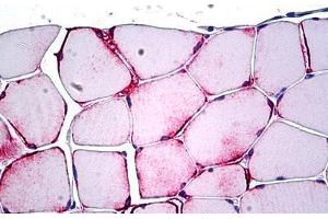Human Skeletal Muscle: Formalin-Fixed, Paraffin-Embedded (FFPE) (PPP1R13L antibody  (AA 75-125))
