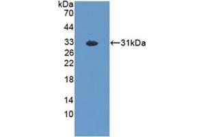Detection of Recombinant EXO1, Mouse using Polyclonal Antibody to Exonuclease 1 (EXO1) (Exonuclease 1 antibody  (AA 1-250))