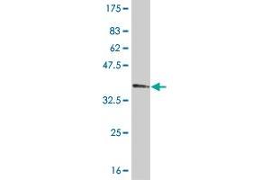 Western Blot detection against Immunogen (36. (TBX2 antibody  (AA 603-702))