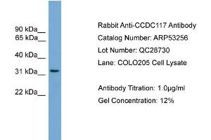 WB Suggested Anti-CCDC117  Antibody Titration: 0. (CCDC117 antibody  (Middle Region))