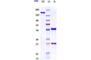 Anti-IL-6 / IFNb2 Reference Antibody (olokizumab) on SDS-PAGE under reducing (R) condition. (Recombinant IL6 (Olokizumab Biosimilar) antibody)