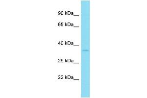 Western Blotting (WB) image for anti-Protein Phosphatase 1, Catalytic Subunit, alpha Isoform (PPP1CA) (C-Term) antibody (ABIN2789191) (PPP1CA antibody  (C-Term))