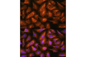 Immunofluorescence analysis of U2OS cells using EIF2B4 Rabbit pAb (ABIN7267037) at dilution of 1:100. (EIF2B4 antibody)