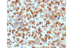 Image no. 3 for anti-DNA Repair Protein Apurinic Endonuclease antibody (ABIN5693483) (DNA Repair Protein Apurinic Endonuclease antibody)