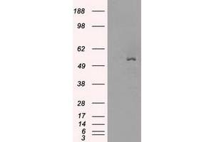 Image no. 4 for anti-Solute Carrier Family 2 (Facilitated Glucose/fructose Transporter), Member 5 (SLC2A5) antibody (ABIN1498477)