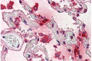 Human Lung (formalin-fixed, paraffin-embedded) stained with TPSAB1 antibody ABIN337204 at 5 ug/ml followed by biotinylated anti-mouse IgG secondary antibody ABIN481714, alkaline phosphatase-streptavidin and chromogen. (TPSAB1 antibody)