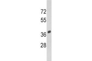 Western blot analysis of SPARC antibody and Y79 lysate. (SPARC antibody  (AA 224-251))