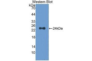 Western Blotting (WB) image for anti-Slit Homolog 2 (Drosophila) (SLIT2) (AA 1160-1333) antibody (ABIN1173398) (SLIT2 antibody  (AA 1160-1333))